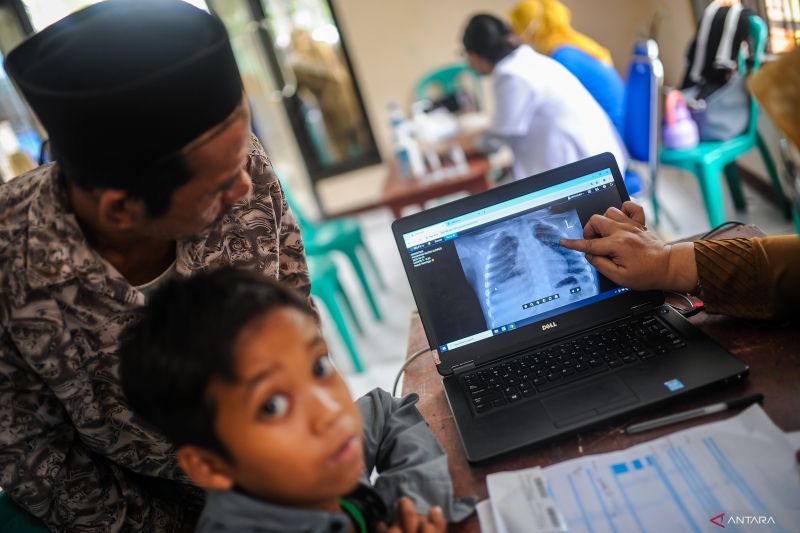 pengendalian faktor risiko jadi cara cegah penularan tbc